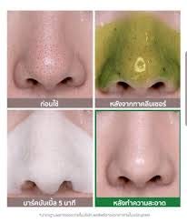 Tratamiento puntos negros - Bye Bye Blackhead 30 Days Miracle Green Tea Tox Bubble Cleanser💥